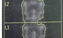 cropped-cropped-cropped-DXA-1.jpg