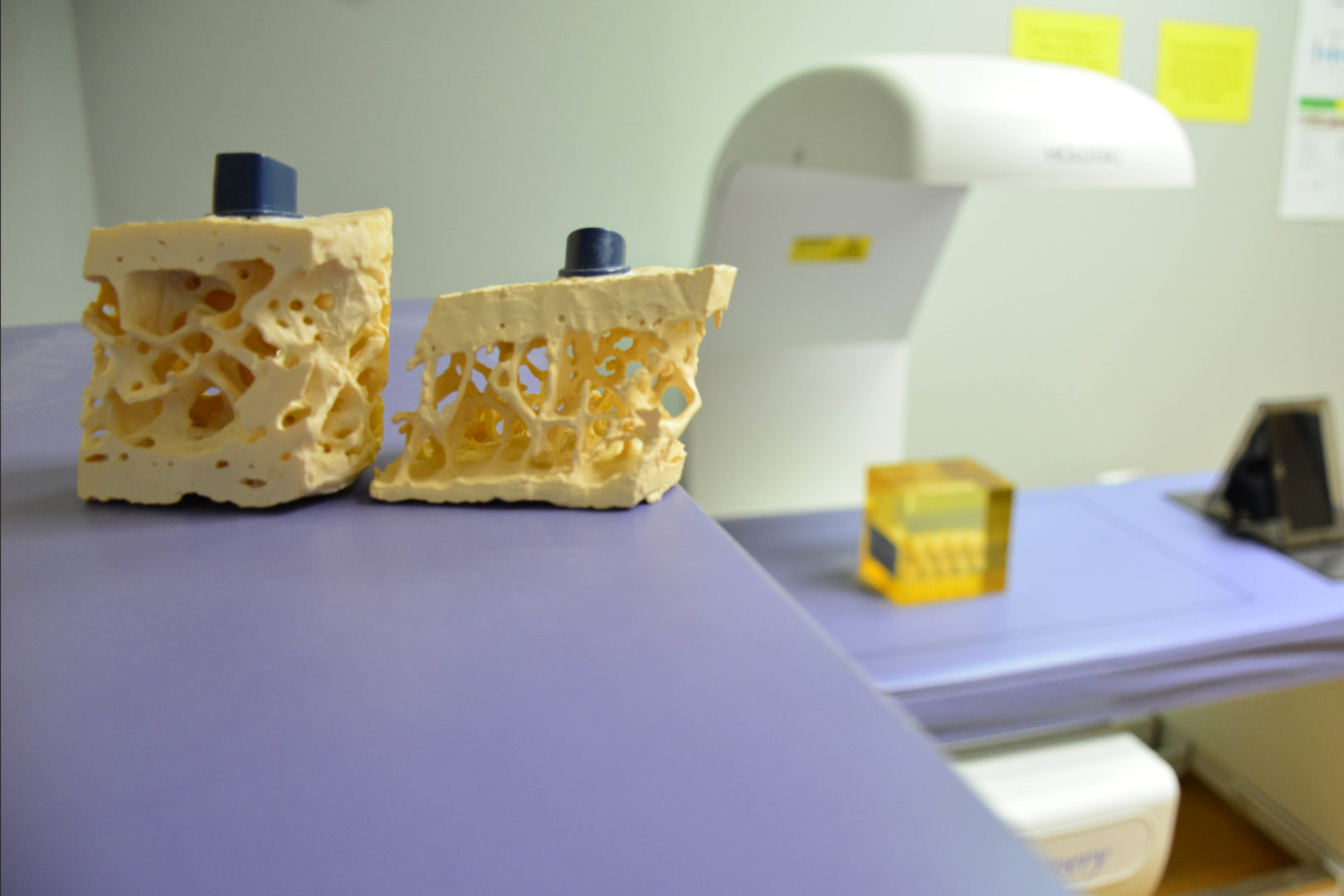 Bone Density Scanning (DXA) Optimum Imaging Center