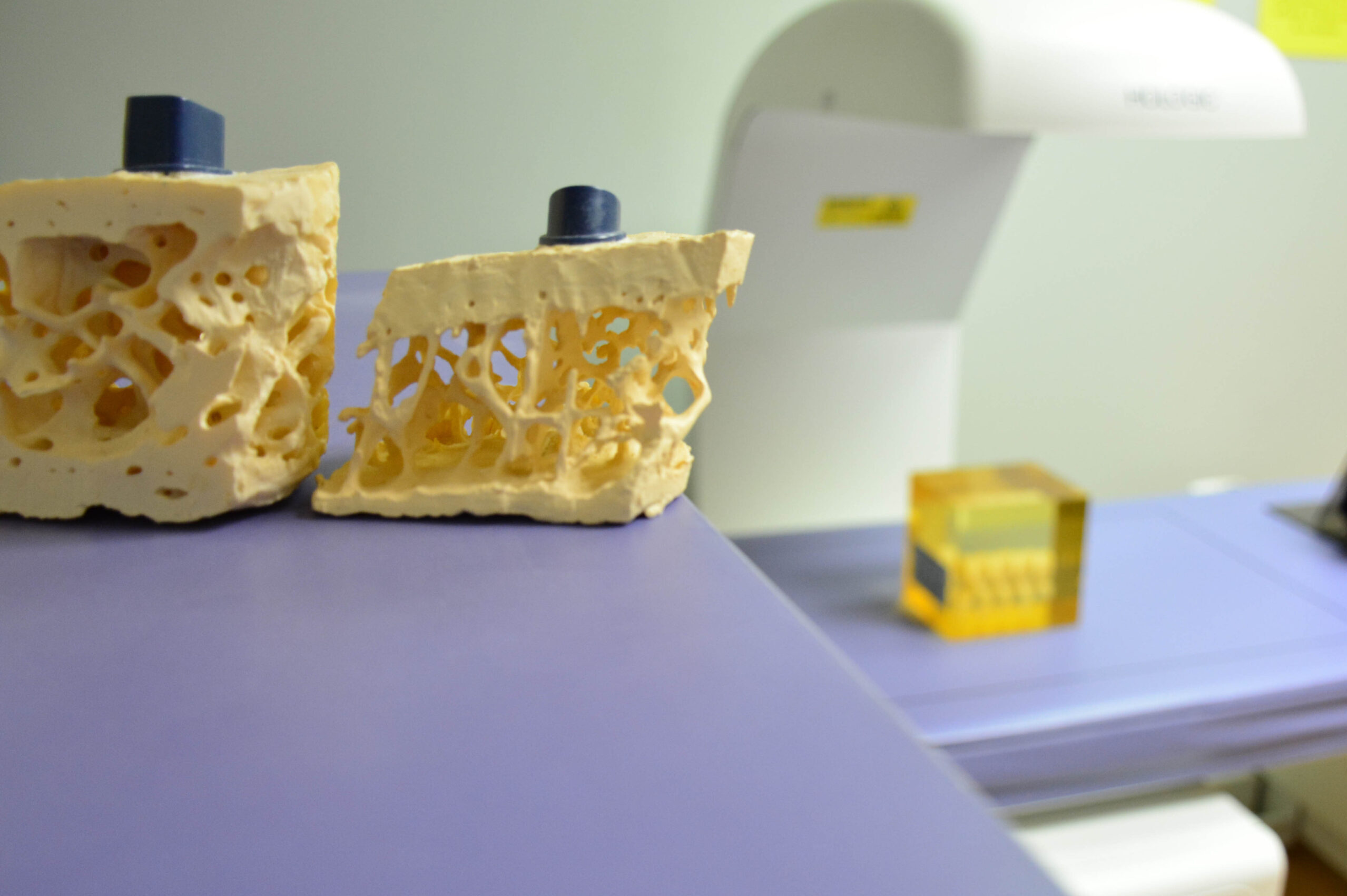 A dental model with a crown and a yellow box on a table.