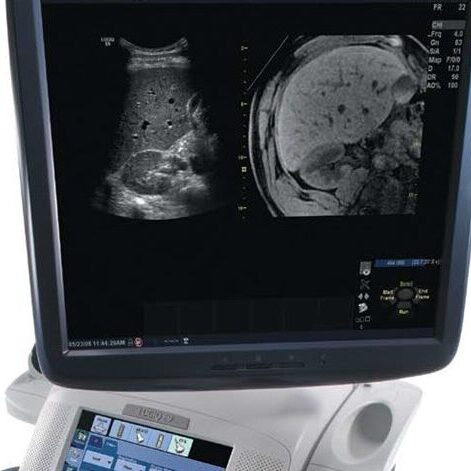 Ultrasound machine displaying a detailed abdominal scan with organ structures.