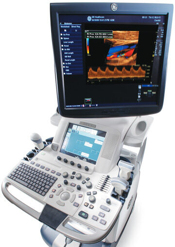 Medical ultrasound machine with monitor and control panel.