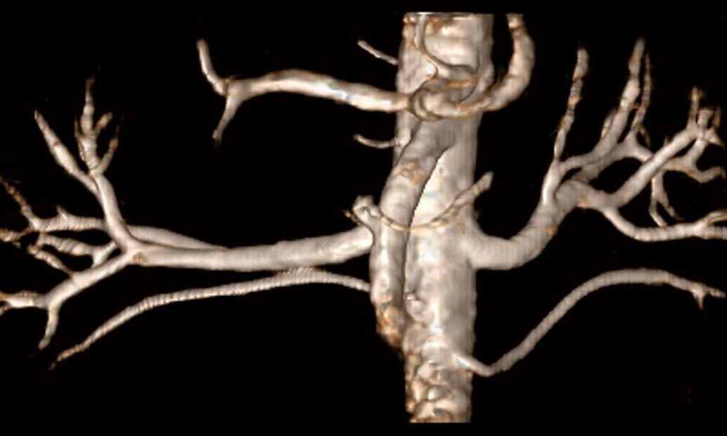 cropped-cropped-MRI-MAGNETOM-Espree-clinical-NATIVE_1800000000130288.jpg 3D medical scan showing detailed vascular structures.