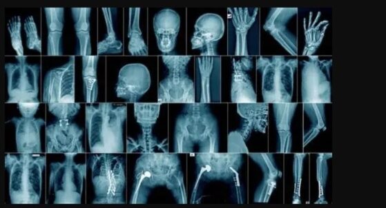 Collage of various X-ray images showing different body parts.